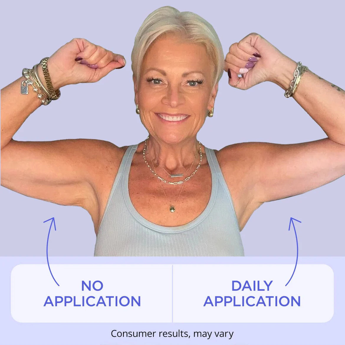 Tighten Sagging Arms in 2 Weeks – Buy 1 Get 1 FREE