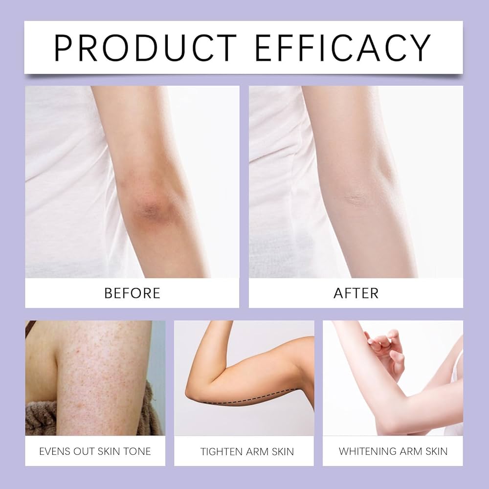 Tighten Sagging Arms in 2 Weeks – Buy 1 Get 1 FREE